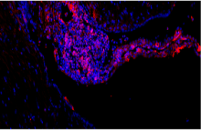 צביעה אימונופלוארסנטית של התאים העצביים המרכיבים את השתל האנושי במח העכבר